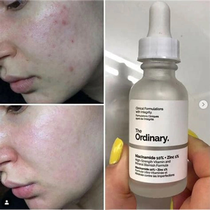 The Ordinary niacinamide 10%+Zinc 1% 30ml