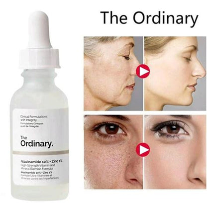 The Ordinary niacinamide 10%+Zinc 1% 30ml